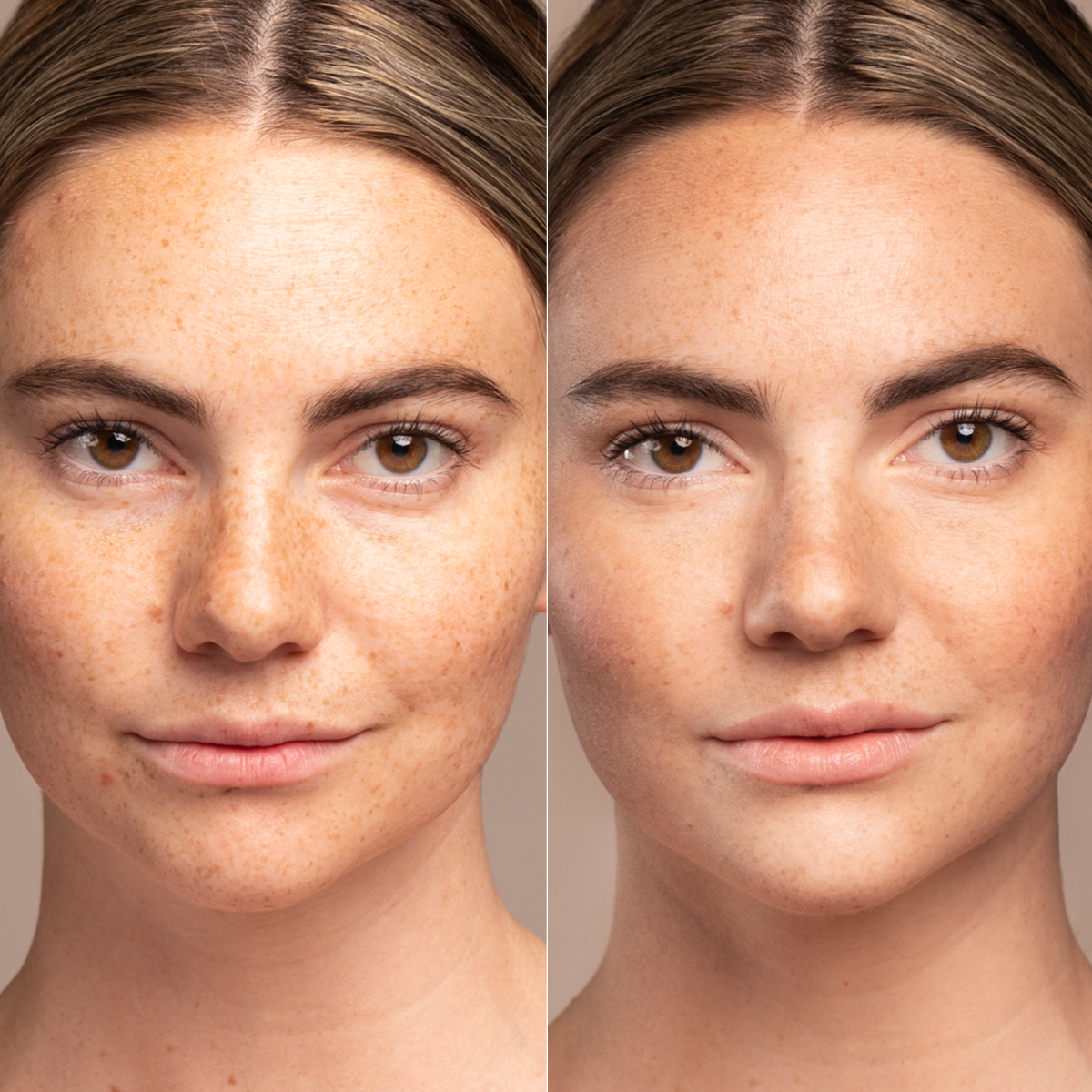 Image Prevention Sun Serum